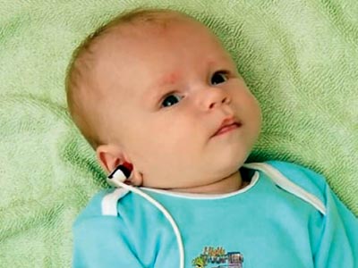 آزمون های الکتروفیزیولوژی شنوایی نوزادان